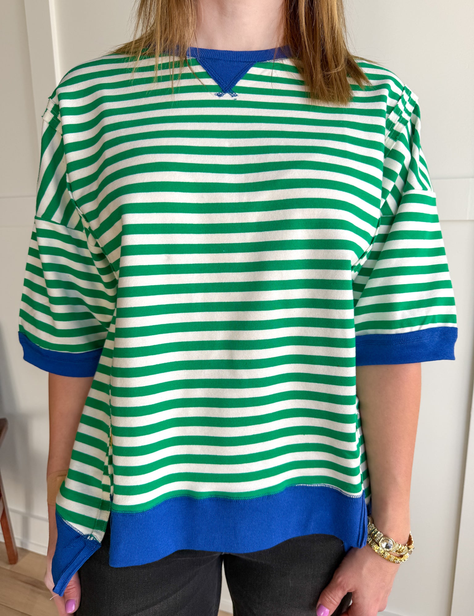 Striped Side Slit Top- Green/Cream - Ana Patricia Boutique